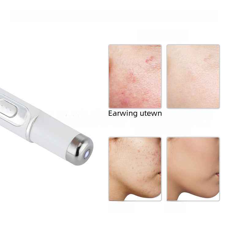 FDA-Cleared Blue Light Acne Killer | No-Skin-Contact Design